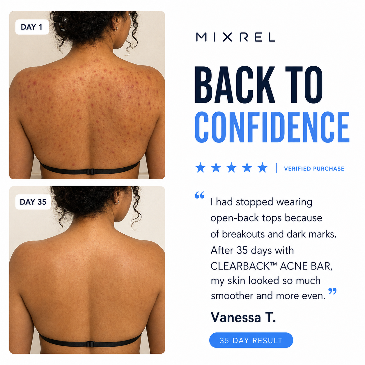 CLEARBACK™  ACNE BAR