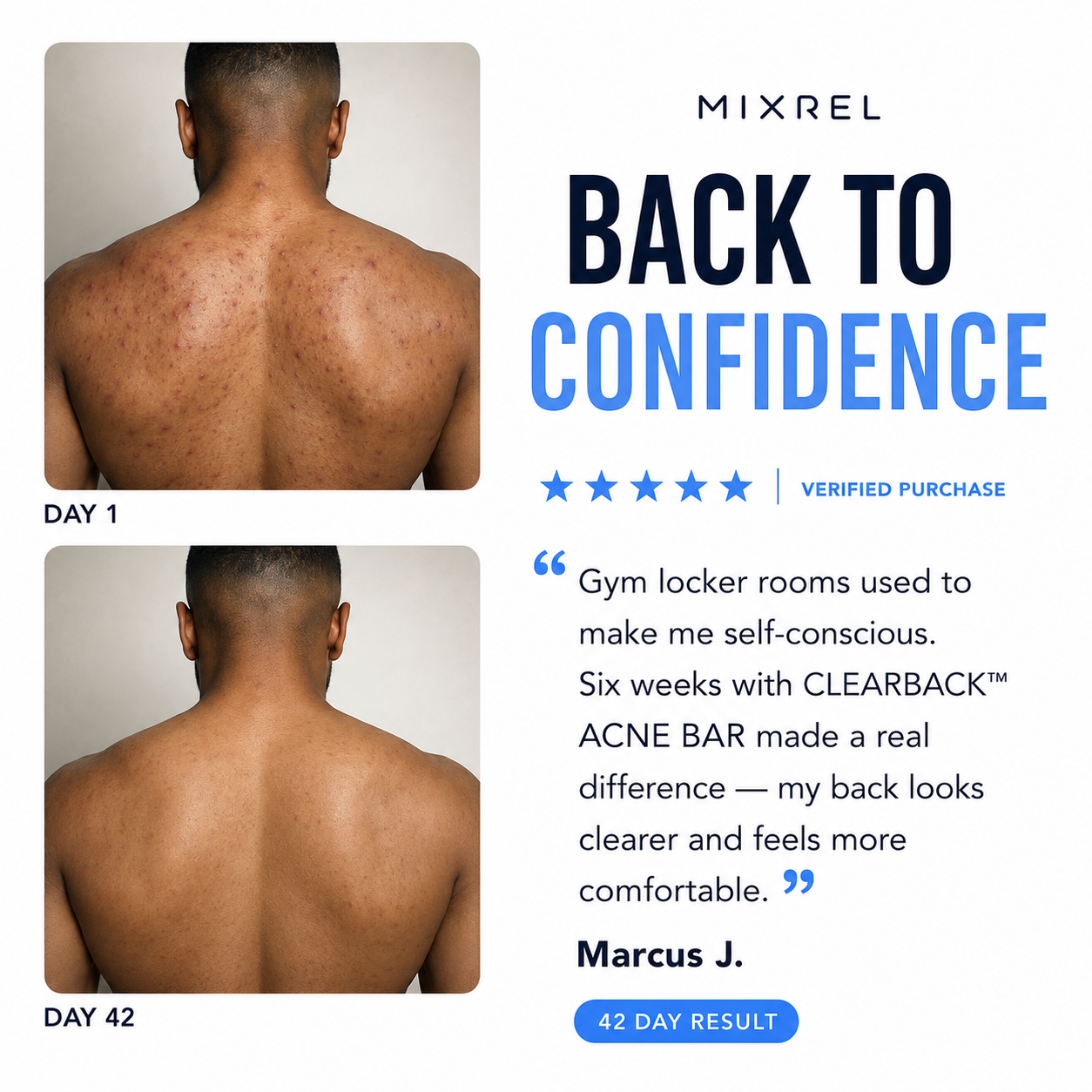 CLEARBACK™  ACNE BAR