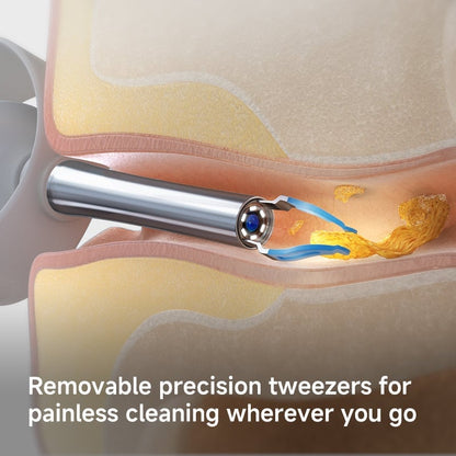 Wireless Endoscopic Ear Scoop👂