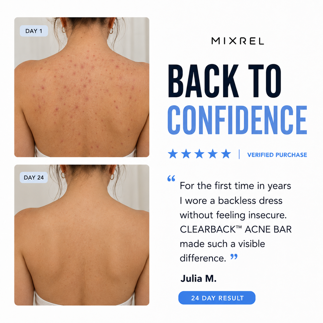CLEARBACK™  ACNE BAR